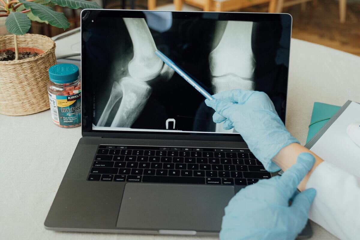 Orthopaedic Trauma And Fracture Care