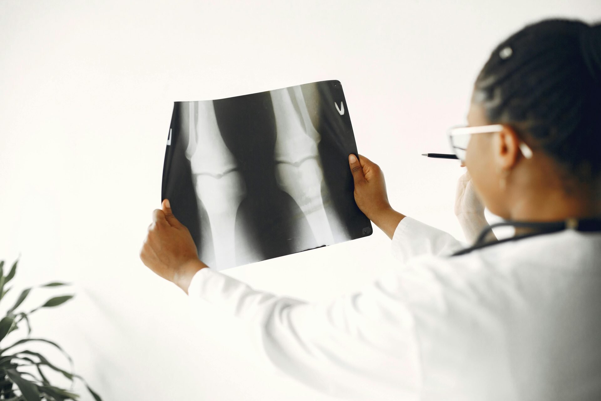 Fracture Care