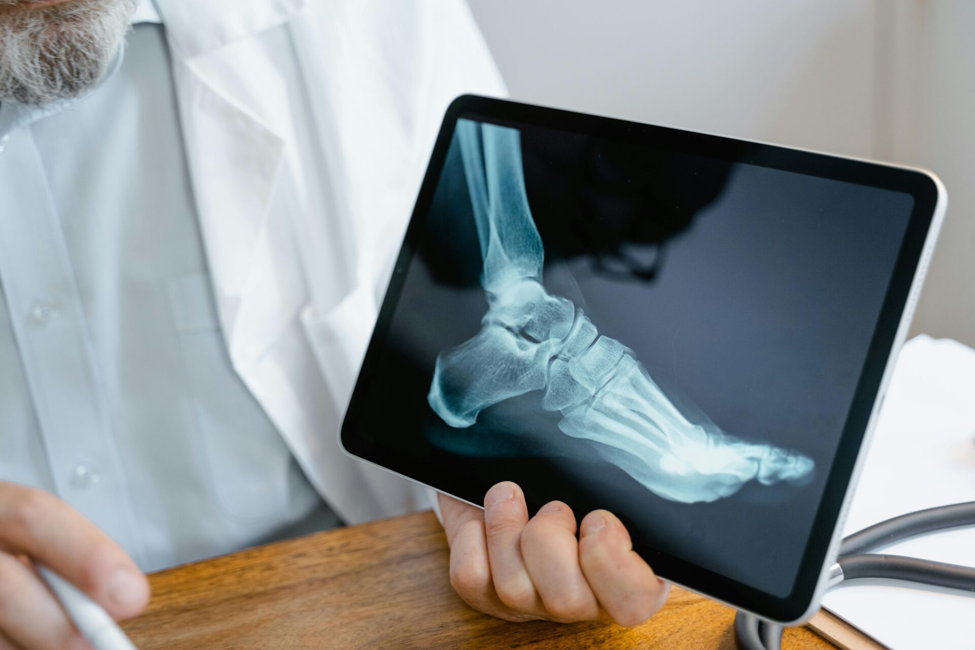 Understanding Ankle Ligaments